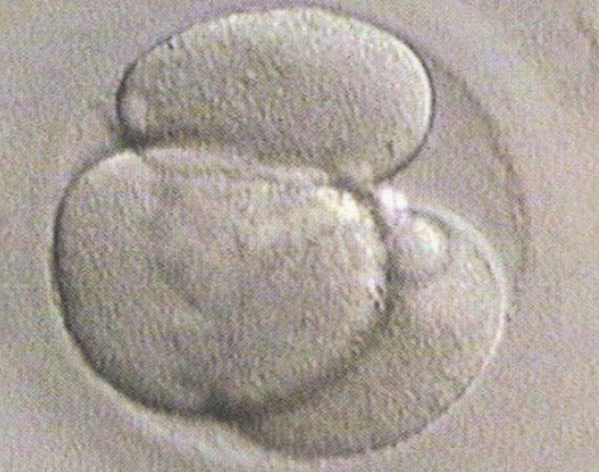 胚胎碎片多的原因有哪些,胚胎的碎片多好还是少好