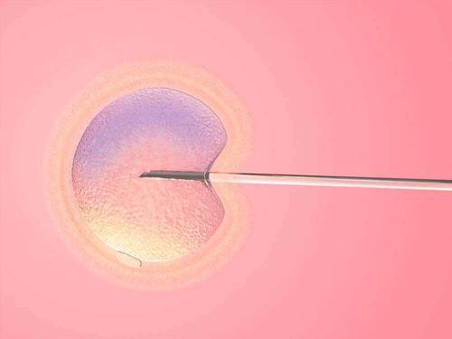 一侧输卵管切除可以做试管婴儿，只要另一侧输卵管是健康的