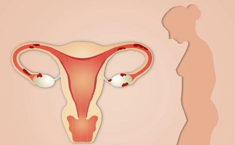 多囊卵巢综合症不是不能生育小孩，试管受精可有效改善生育力