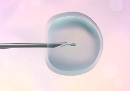 超长方案试管，是如何帮助治疗不孕不育的？