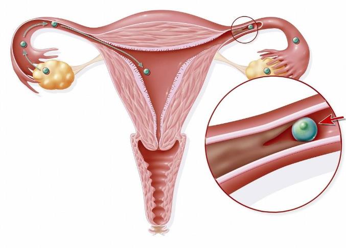 输卵管检查有必要做吗？
