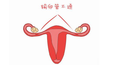 郑州有哪些医院，治疗输卵管效果如何？