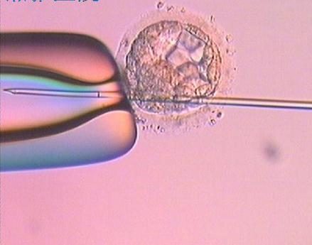 试管移植胚胎是治疗不孕不育的常见方法，它的成功率一般为45％