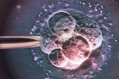 试管胚胎和囊胚，有什么区别？
