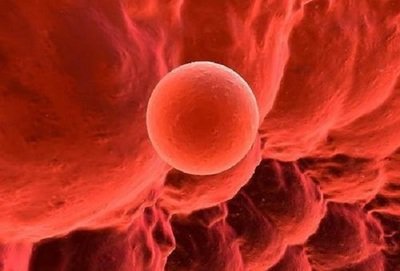 试管移植一个胚胎，探索不孕不育的答案