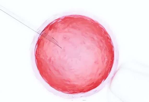 【生殖吧】单精子注射IVF技术的成功率