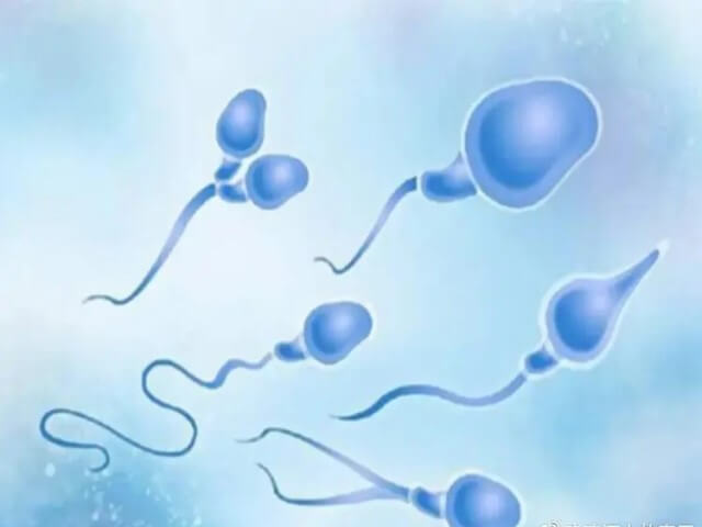 精子活力低，影响试管婴儿成功率吗？