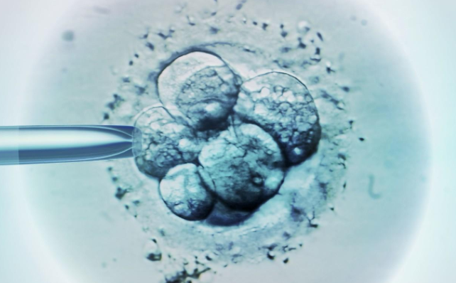 试管取卵移植冻胚：有效治疗不孕不育