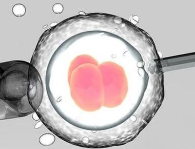 探讨试管取卵24个可否当月移植，宁波妇儿医院可以当月移植吗？