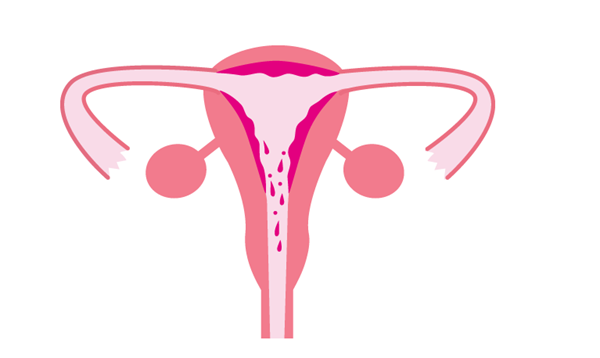 女性子宫内膜薄可以做试管婴儿吗？
