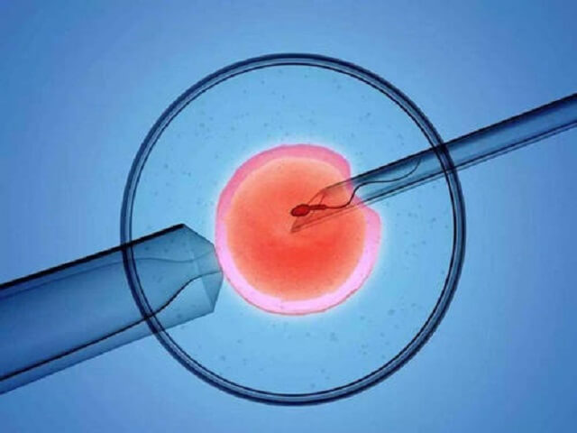 试管婴儿桑椹胚，意味着新的机遇与挑战
