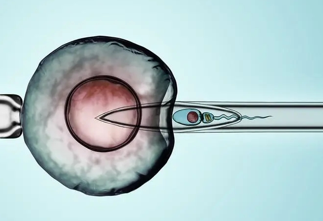 输卵管结核做试管婴儿适合哪种促排方案?
