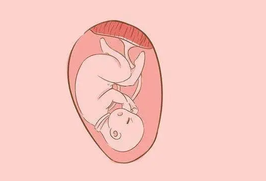 胎儿正常但宫内有积血怎么办, 怀孕为什么会宫腔积血