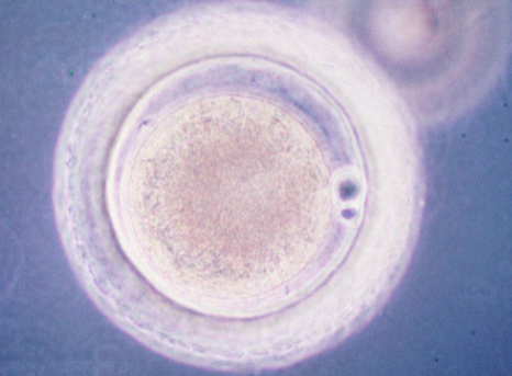 试管选择囊胚移植一次放置几个胚胎？