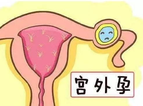 输卵管堵塞怀孕了一定会变成宫外孕吗？