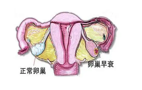 卵巢功能不好也能做试管婴儿！试管技术能帮助卵巢功能不好的女性受孕