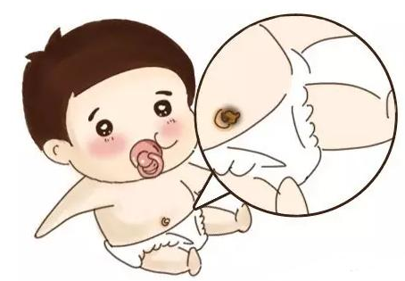 新生儿满月之后肚脐上的脐带是否会掉？