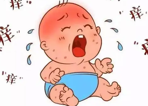 宝宝出现湿疹的时候可以用牛奶洗脸吗？