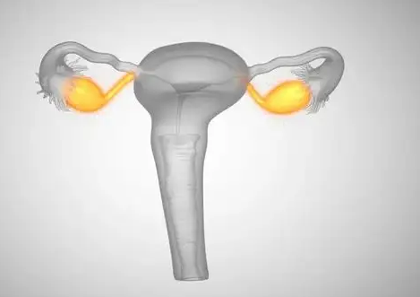 年轻女性预防子宫癌的方式有哪些？