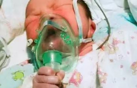 新生儿湿肺会对宝宝以后的健康情况有影响吗？