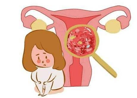 造成子宫内膜炎最常见的病因有哪些？