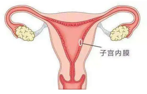 患子宫内膜炎会对女性备孕带来影响吗？