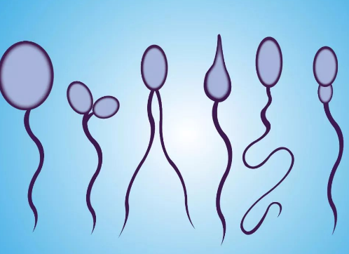 畸形精子99%做试管婴儿还能成功吗？