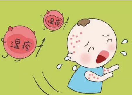 新生儿湿疹用什么药膏涂抹最合适？