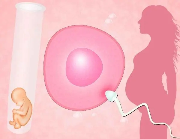 阴道炎患者在郑州做一次试管婴儿需要多少费用？