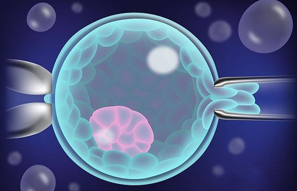 高雄激素血症过高做试管婴儿鲜胚移植成功率有多少？
