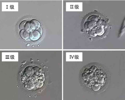 如何辨别试管婴儿胚胎的质量?试管胚胎质量差的标准有哪些？