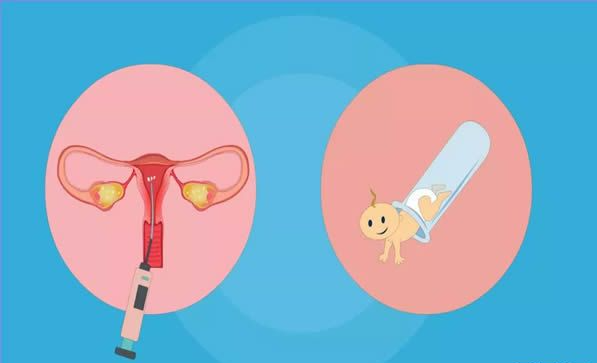 输卵管积水2cm可以先调理之后在进行试管婴儿吗？