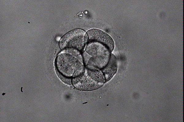 取卵后的胚胎等级是如何分类的？医学专家来为你揭秘！