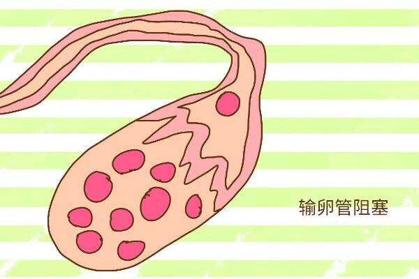 输卵管堵塞在香港医院做三代试管婴儿选性别多少钱？