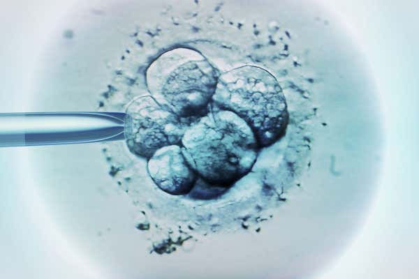 卵巢肿瘤在合肥做试管要多少钱?