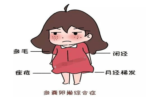 多囊卵巢综合征在郑州做试管能报销吗？