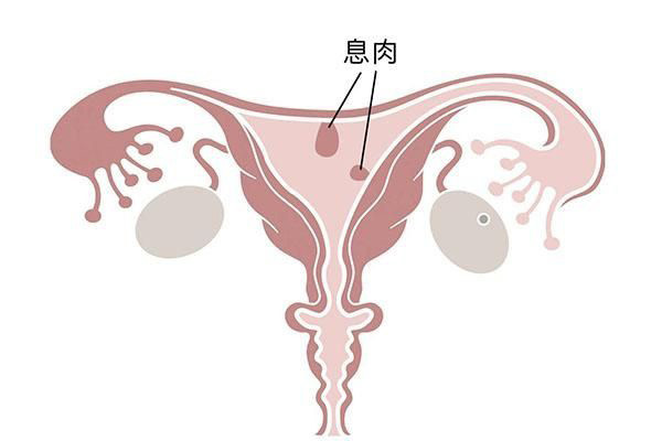 子宫内膜息肉在上海做试管要多少钱？试管前需要做宫腔镜吗?
