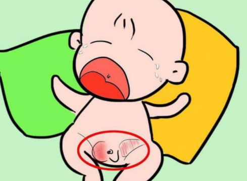 脐疝带会对宝宝的发育带来影响吗？
