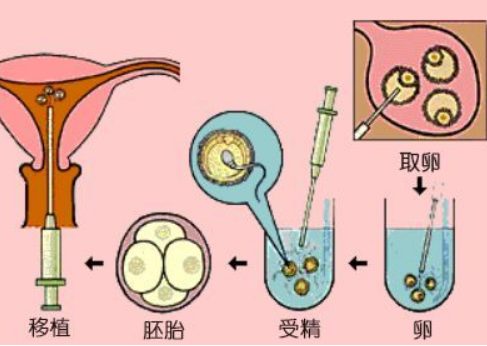 卵巢囊肿手术后可以直接做试管移植胚胎吗？