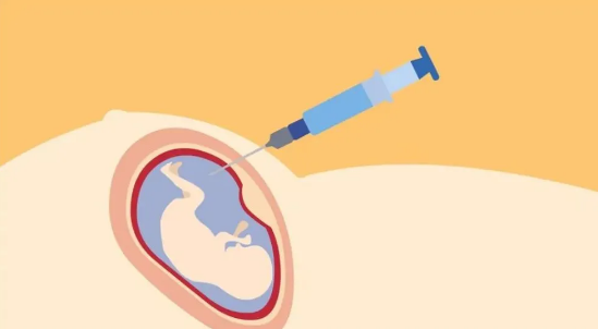 高龄孕妇必须做羊水穿刺检查吗，及早发现孕期风险
