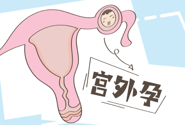 试管婴儿和宫外孕有什么关系？试管婴儿的成功率有多高？