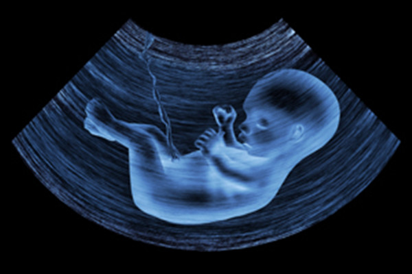 胎儿心脏彩超不配合趴着怎么调整？