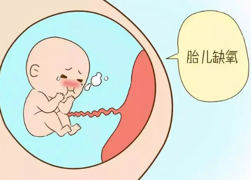 胎儿出现缺氧的情况后孕妇会出现什么感觉呢？