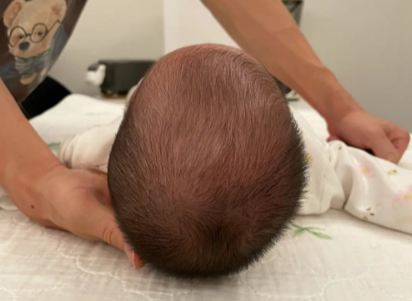 宝宝的头型在发育到什么时候才会定型？