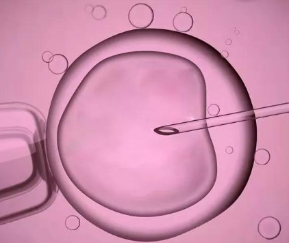高龄做试管婴儿一般移植几个囊胚好？附成功经验