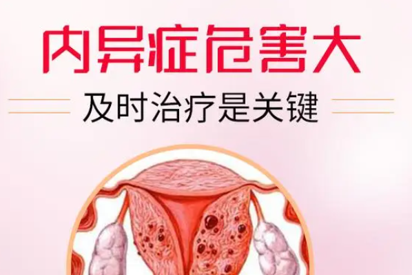 青岛哪家公立三甲医院治疗子宫内膜异位症技术最为领先？