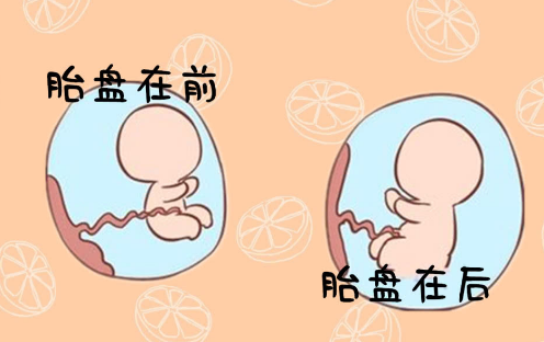 胎盘位置在子宫后壁生男生女的概率各是多少？