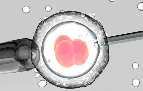 试管婴儿胚胎移植完为什么要马上排尿？原因是这样做有3大好处
