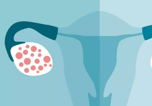 患有多囊的女性做试管可以不降调直接进行促排吗？