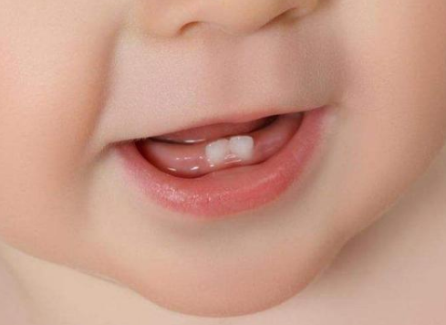 八个月的宝宝还没有长牙齿是发育迟缓的表现吗？